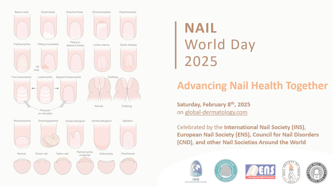 Nail Disorders Management