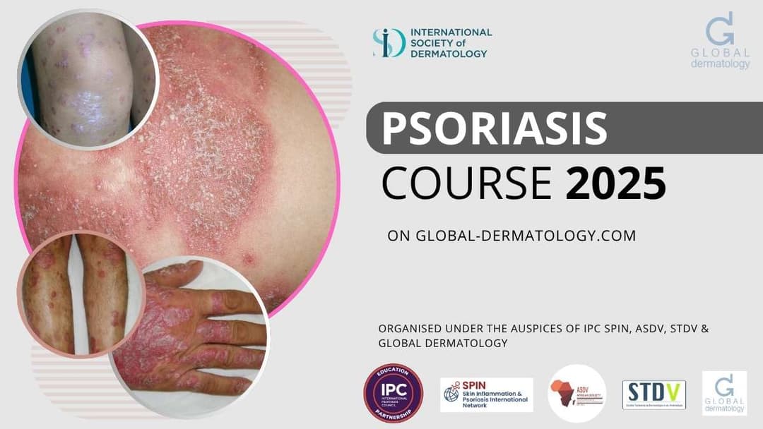 Psoriasis Courses