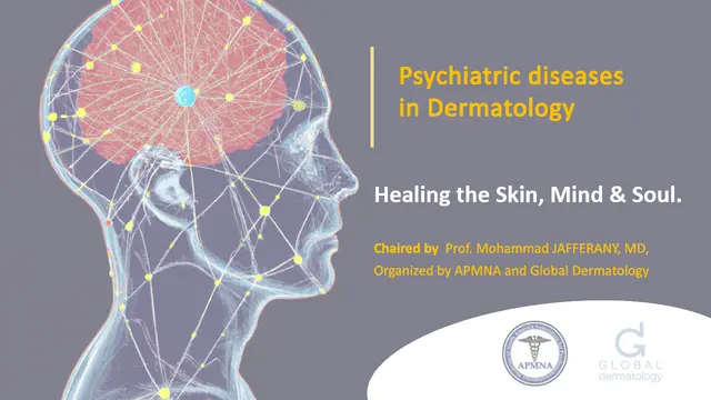 Management of Dermatological Delusional Disorders