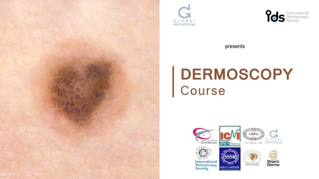 Dermoscopy