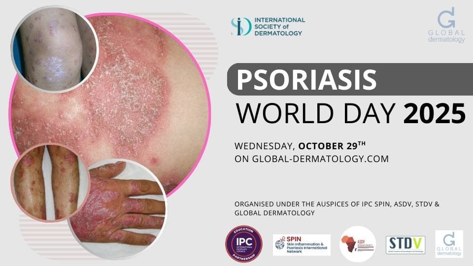 PSORIASIS | World Day 2025