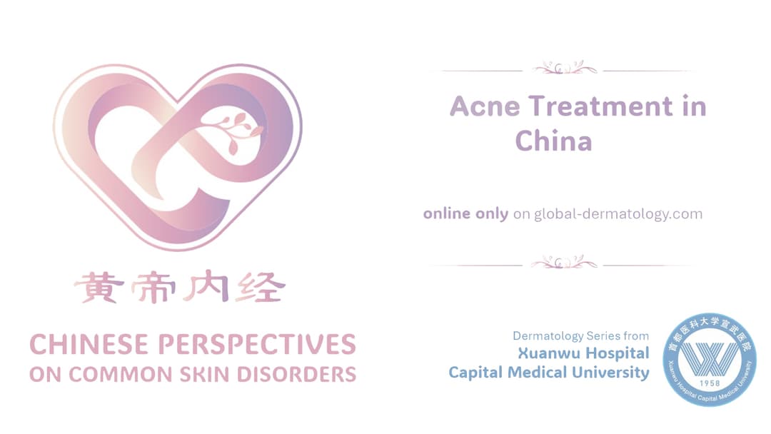 Acne Treatment in China