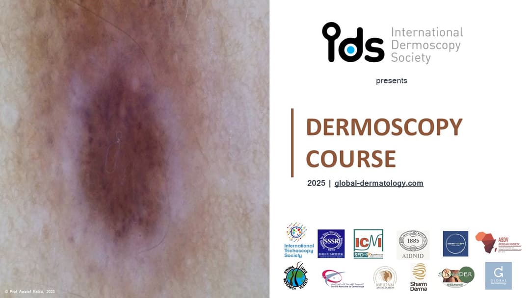 Topographic Dermoscopy